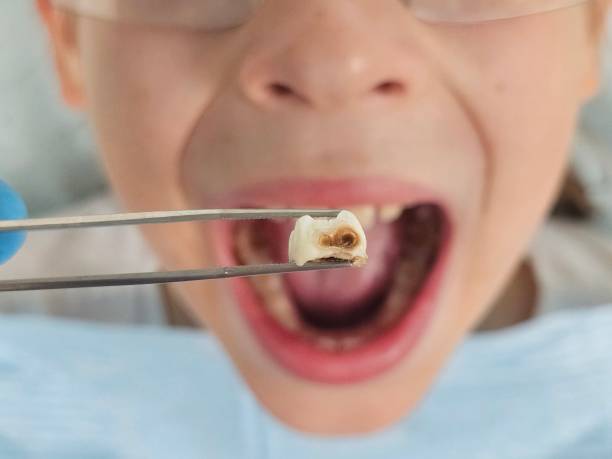 Best Weekend Emergency Dentist in Natalia, TX