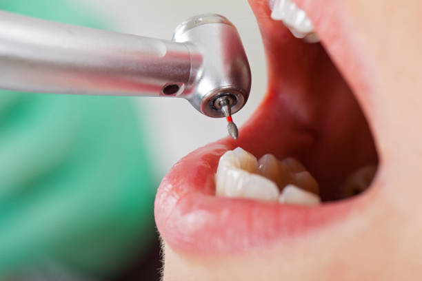 Best Orthodontic Emergency Dentist in Natalia, TX